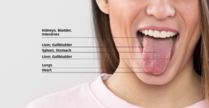 Tongue Diagnosis